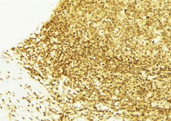 SGK1 / SGK Antibody