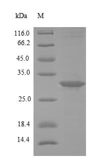 Brucella abortus vjbR Protein (Recombinant 6His, N-terminus)