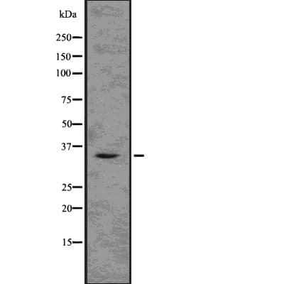 Polyclonal Rabbit anti-Human TMX2 / TXNDC14 Antibody (IHC, WB)