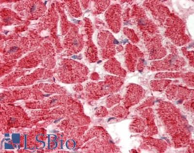 IHC-plus™ ATP5B / ATP Synthase Beta Antibody