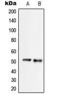 Polyclonal Rabbit anti-Human SERINC2 Antibody (C-Terminus, IHC, WB)