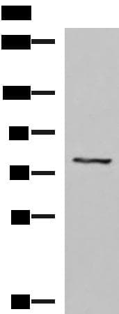 Polyclonal Rabbit anti-Human TGFBI Antibody (IHC, WB)