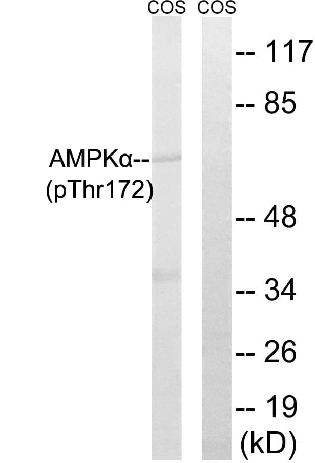 Polyclonal Rabbit anti-Human PRKAA1 + PRKAA2 Antibody (phospho-Thr172, IHC, WB)