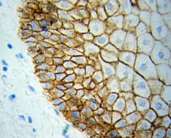BCL2L1 / BCL-XL Antibody