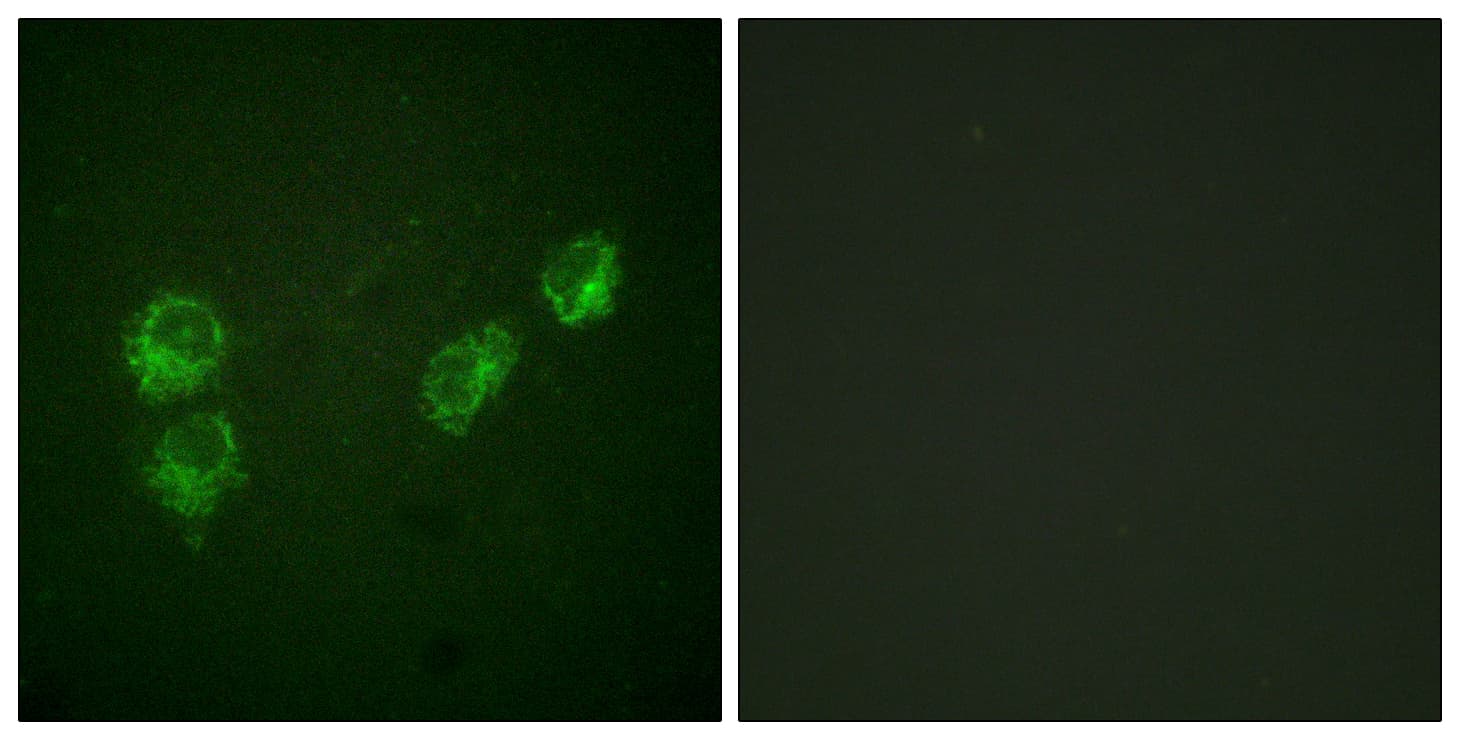 PLN / Phospholamban Antibody (phospho-Ser16)