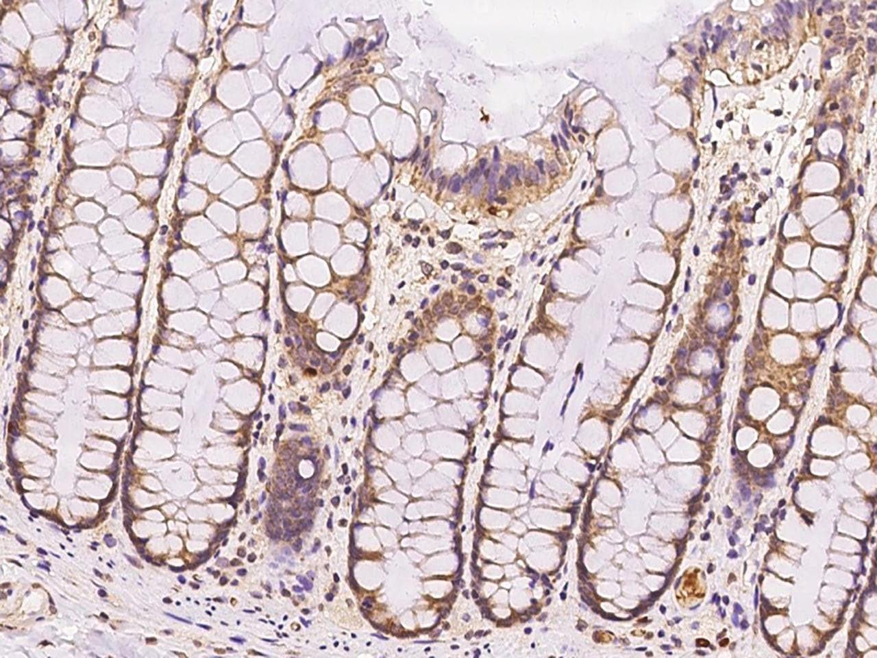 RABGGTA Antibody