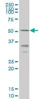 ENTPD5 / CD39L4 Antibody (clone 4A5)