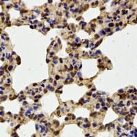 Polyclonal Rabbit anti-Human FBXW11 Antibody (IHC, IF, WB)