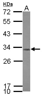 CCDC44 / TACO1 Antibody