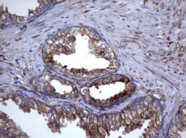 CD30 Antibody (clone OTI16H5)