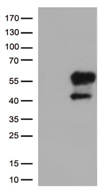 HAVCR2 / TIM-3 Antibody (clone OTI4E4)