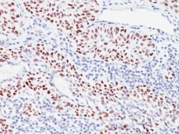 CDKN1C / p57 Kip2 Antibody (clone 57P06, Ready-to-Use)