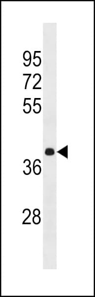 IHC-plus™ HNRNPA3 / HnRNP A3 Antibody (aa30-57)