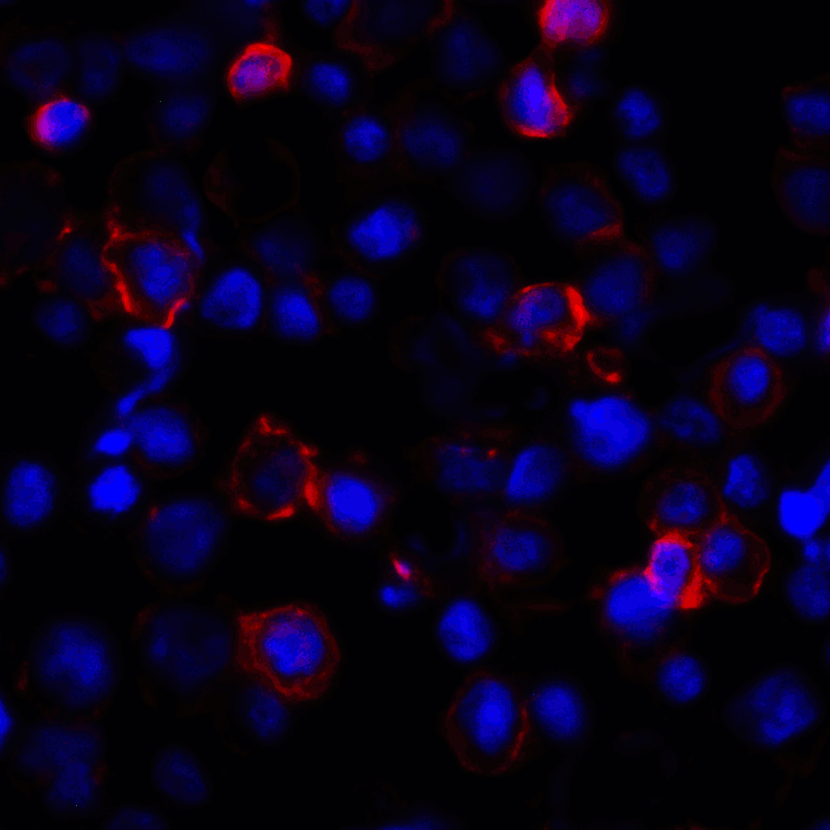 CD274 / B7-H1 / PD-L1 Antibody (clone 1F11)