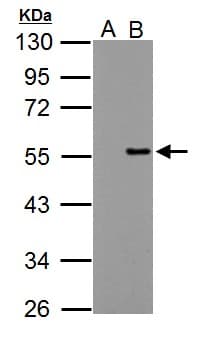 PPP4R2 Antibody