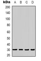 PRKAB2 / AMPK Beta 2 Antibody