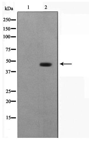 ILKAP Antibody