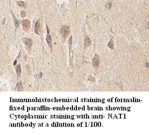 NAT1 / AAC1 Antibody