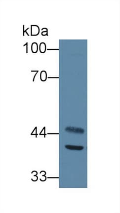 SCAD / ACADS Antibody