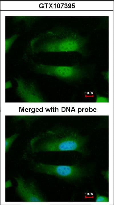 Polyclonal Rabbit anti-Human SEPHS1 / SPS Antibody (aa1-204, IHC, WB)