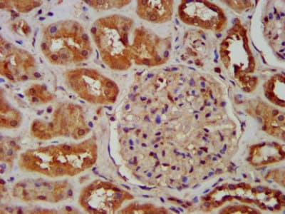 Polyclonal Rabbit anti-Human SNX12 Antibody (IHC, IF)