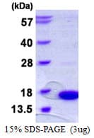 Human SH3BGRL Protein (Recombinant His)