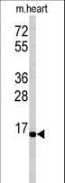 Polyclonal Rabbit anti-Human UBE2G1 Antibody (aa1-30, IHC, WB)
