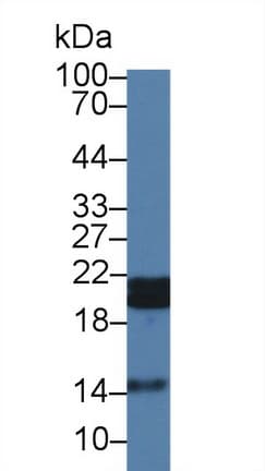 HSPB7 / CvHSP Antibody (aa1-170, APC)