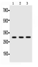 Polyclonal Rabbit anti-Human Adiponectin Antibody (aa19-244, IHC, WB)