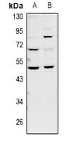 BMP12 / GDF7 Antibody
