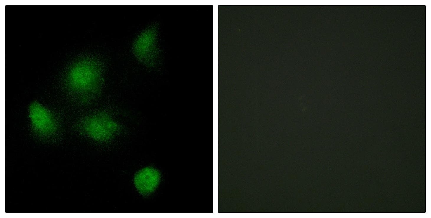 Polyclonal Rabbit anti-Human SIN3B Antibody (IF, WB)