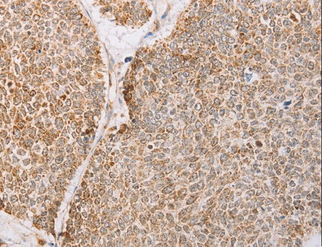 YARS2 Antibody