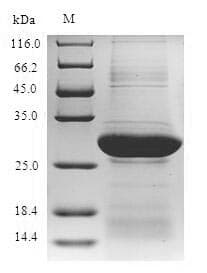 Human NKRF / NRF Protein (Recombinant 6His, N-terminus)