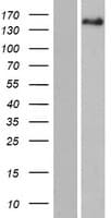 PITPNM2 / NIR3 Protein (Over-Expression Lysate Myc-DDK (Flag))