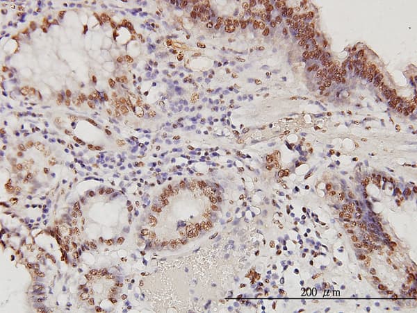Monoclonal Mouse anti-Human PSME2 Antibody (clone 1G4, IHC, WB)