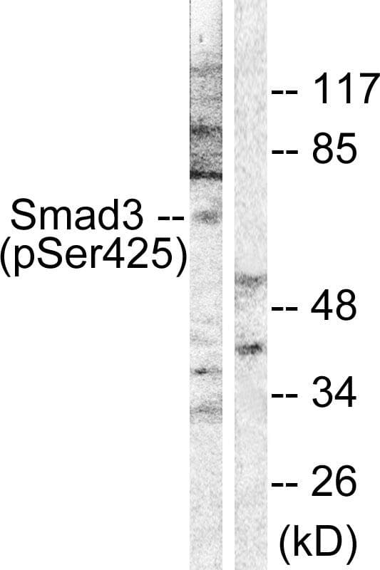 Polyclonal Rabbit anti-Human SMAD3 Antibody (phospho-Ser425, IHC, WB)