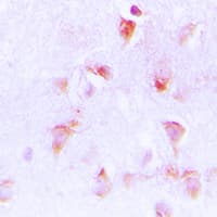 GC1qR / C1QBP Antibody (Internal)
