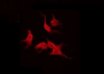 ABCC13 Antibody