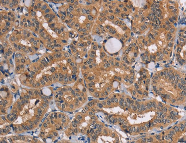 TRAFD1 / FLN29 Antibody
