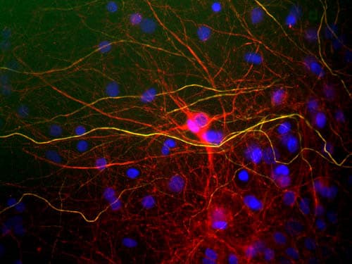 IHC-plus™ NF-L / NEFL Antibody