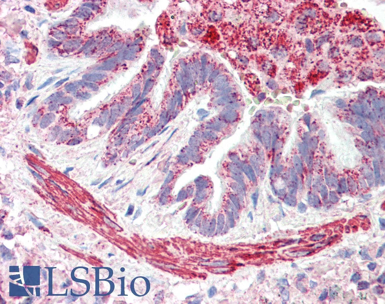 IHC-plus™ Polyclonal Goat anti-Human MOB2 Antibody (aa97-109, IHC, WB)