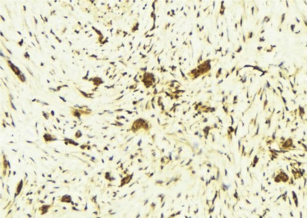 STAT6 Antibody