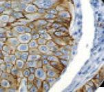 ERBB2 / HER2 Antibody (clone RBT-HER2)