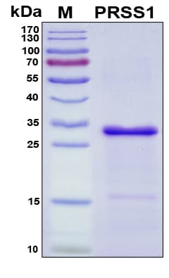Human PRSS1 / Trypsin Protein (Recombinant His, N-Terminal)