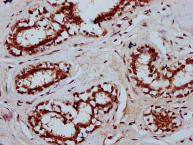 Polyclonal Rabbit anti-Human TSEN15 Antibody (IHC)