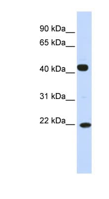 SSX4 Antibody (N-Terminus)