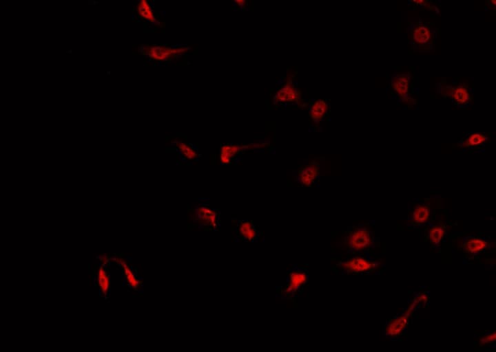 CCNH / Cyclin H Antibody (phospho-Thr315)