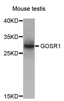 GS28 / GOSR1 / p28 Antibody