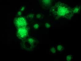Monoclonal Mouse anti-Human MAPK7 / ERK5 Antibody (clone OTI1A4, IF, WB)