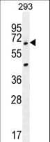 ANKRD34B Antibody (aa467-495)